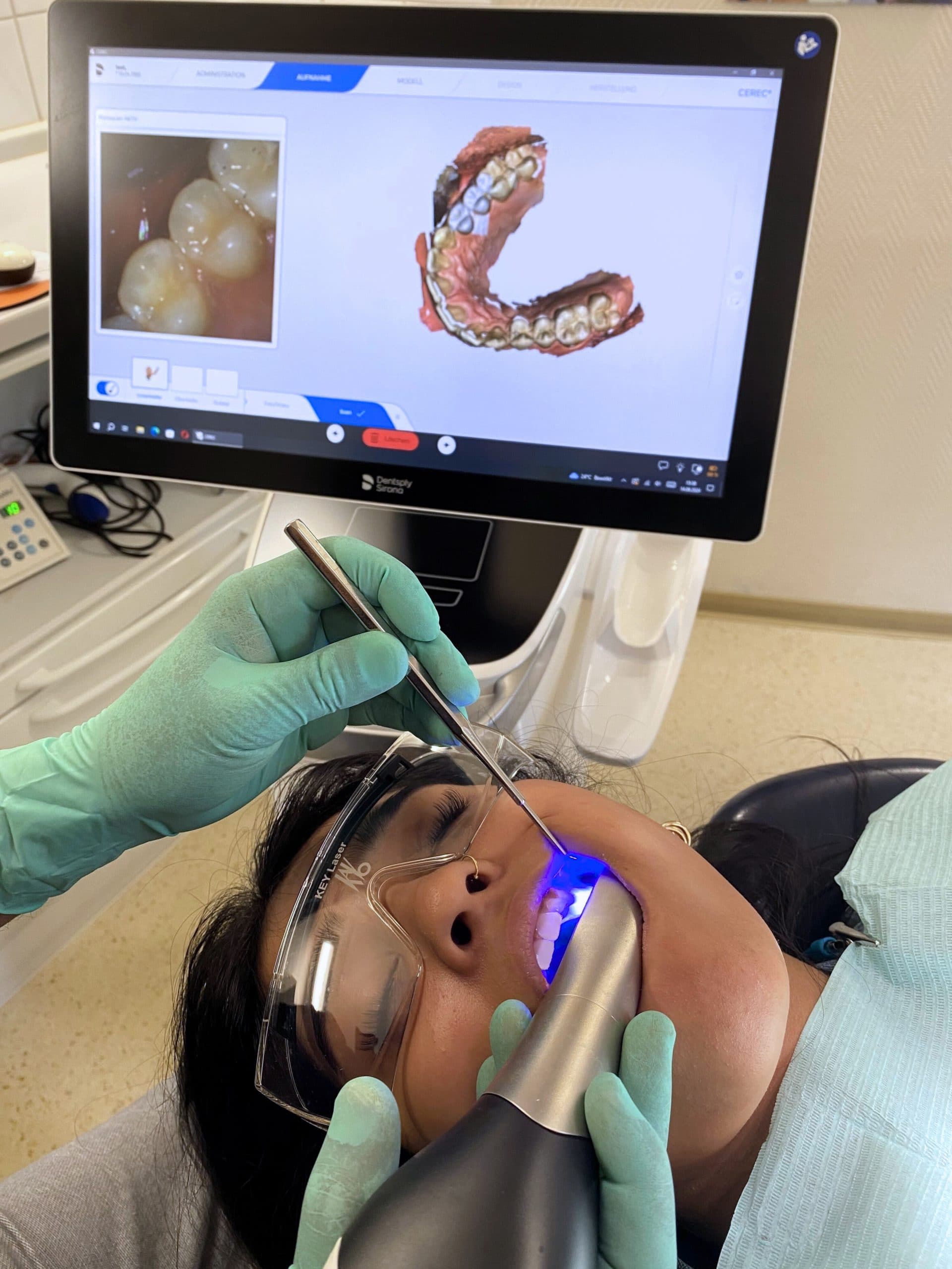 Patientin erhält präzise CEREC Laser Side Chair Therapie für Zahnrestauration vor einem Bildschirm mit digitalem Zahndesign.